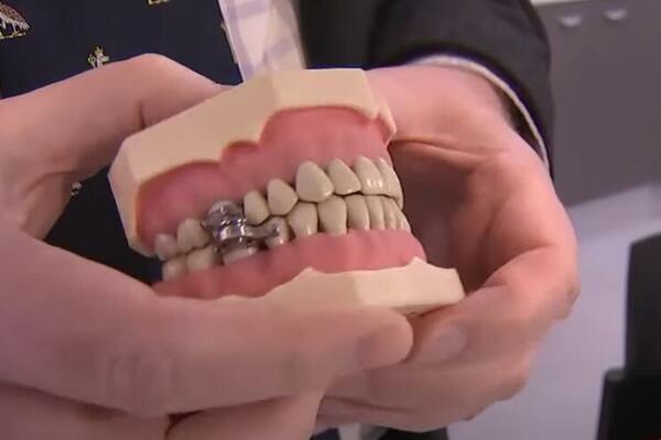 POVRATAK U MRAČNO DOBA! PROTIV GOJAZNOSTI SE BORE ZAKLJUČAVANJEM VILICE: Stručnjaci upozoravaju na opasnost (VIDEO)