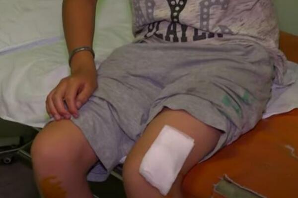 ODLUČILA JE DA SAMA ISTISNE RANU NA KOLENU SVOG SINA: Kada je OVO IZAŠLO iz nje, odmah je počela da VRIŠTI (FOTO)