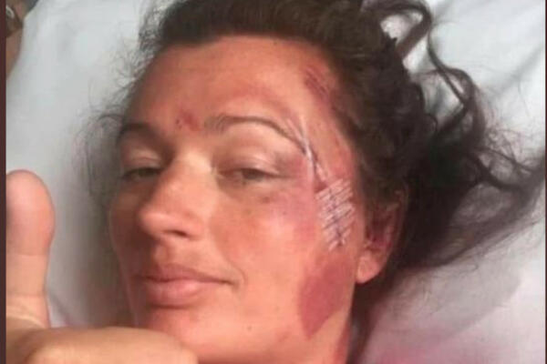 PREŽIVELA STRAVIČNU NESREĆU: Pala sa litice visoke 20 metara!