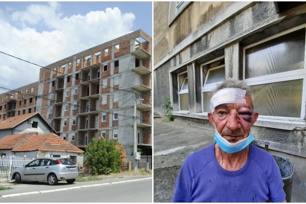 MILORAD IZ KRNJAČE TVRDI DA GA JE PRETUKAO INVESTITOROV SIN! Seo je na mene i počeo da me pesniči u glavu!