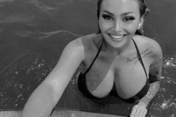 SPUCALA PREKO 20,000 EVRA NA OPERACIJE DA BI LIČILA NA PLASTIČNU LUTKU: Ima neviđeni PROBLEM, i dalje je NE ŽELE!