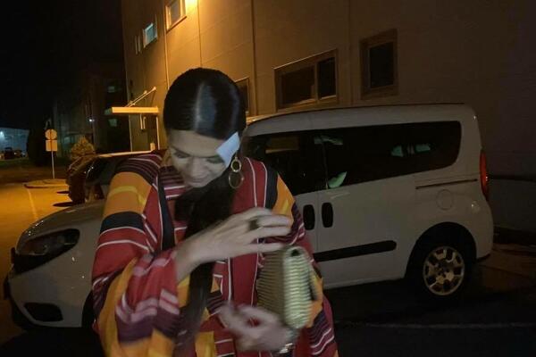 RIALDINA MAMA NAKON PADA SAMO ZA ESPRESO: Mora da ide na UŠIVANJE, hitno se uputila u bolnicu!