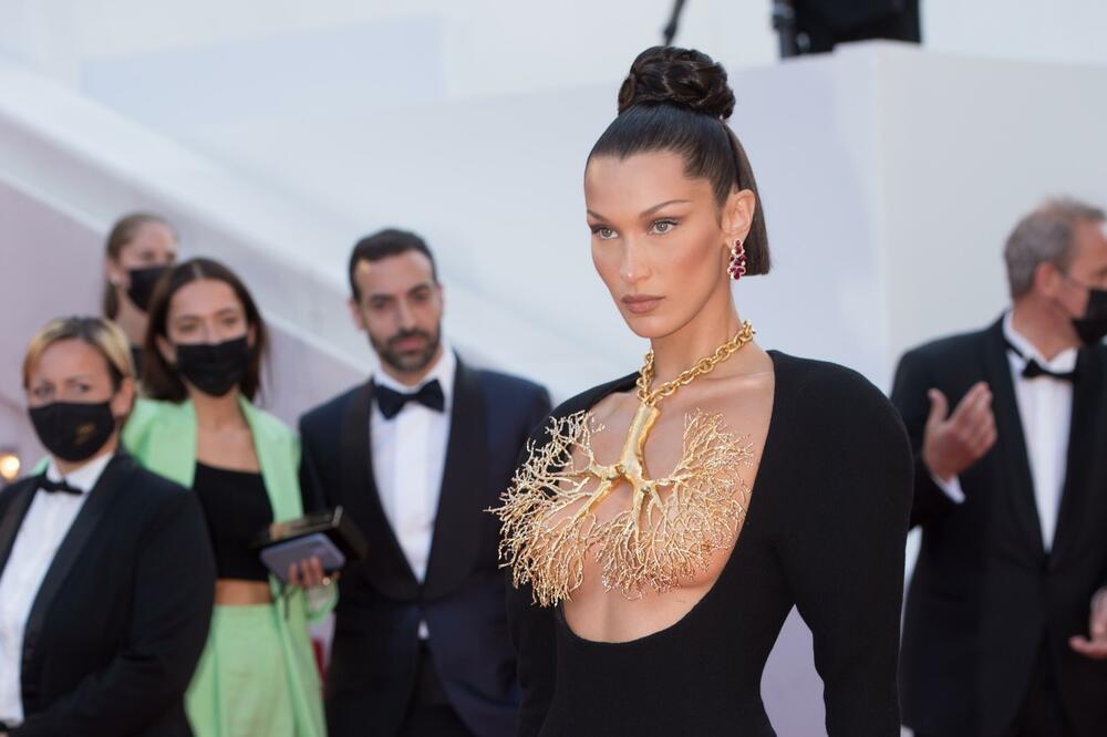 PUNA JE PARA I IMA BOŽANSKU LEPOTU, A MNOGO JE NESREĆNA: Bolest ju je potpuno uništila!