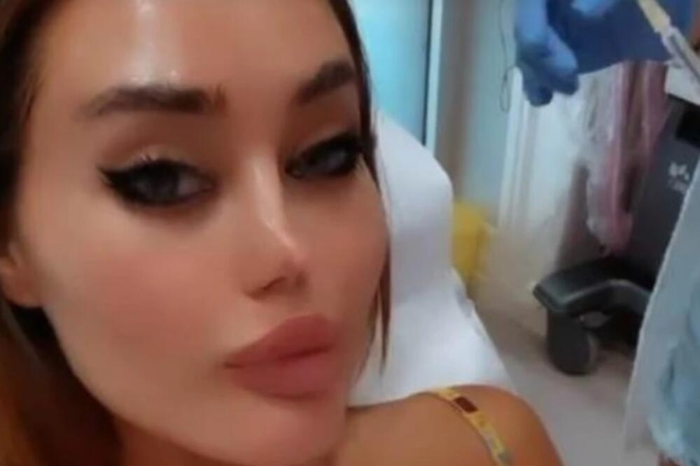 SKAMENILA SE! Srpska STARLETA puna BOTOKSA, a ima samo 27 GODINA: ZATEGNUTO DO BOLA!