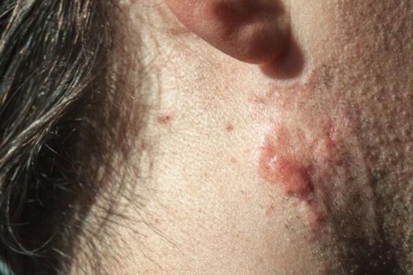 ZNAKOVI RAKA SE NE JAVLJAJU NA OVOM DELU TELA: Sve vreme ste u zabludi