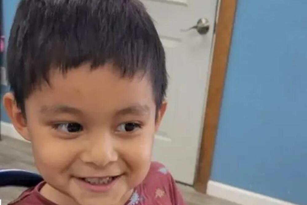 HOROR, DETE UMRLO U TOKU VAĐENJA ZUBA: Porodica u ŠOKU, svi su van sebe! (FOTO)