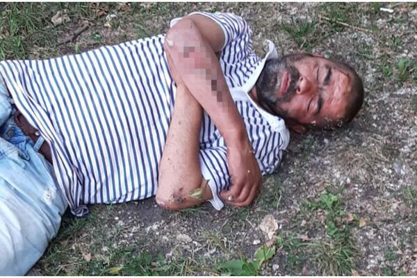 RUSKINJA JE OBJAVILA SLIKU BESKUĆNIKA, A NA NJOJ JE BIO STANKO! Srbin tumarao u ranama, a njegova priča je sam BOL!