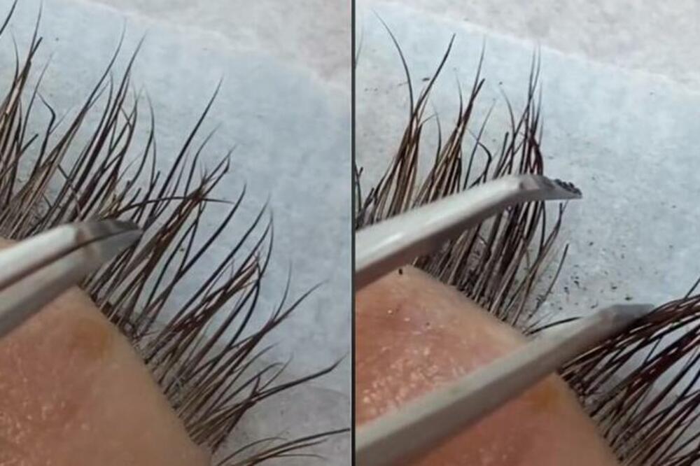 POGLEDAJTE KAKO METALNI UVIJAČ LOMI TREPAVICE: Više ga nikada nećete uzeti u ruke! (FOTO)