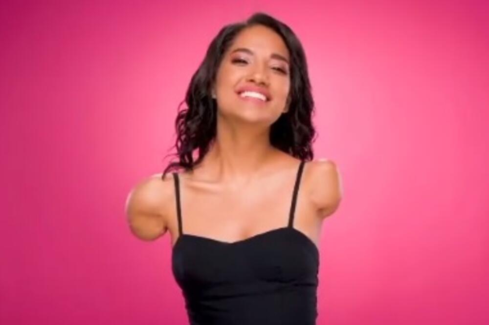 VIKTORIJA RUŠI SVE STEREOTIPE! Nema OBE RUKE i JEDNU NOGU, doživela je STRAVIČNU NESREĆU kada je imala 5 GODINA!