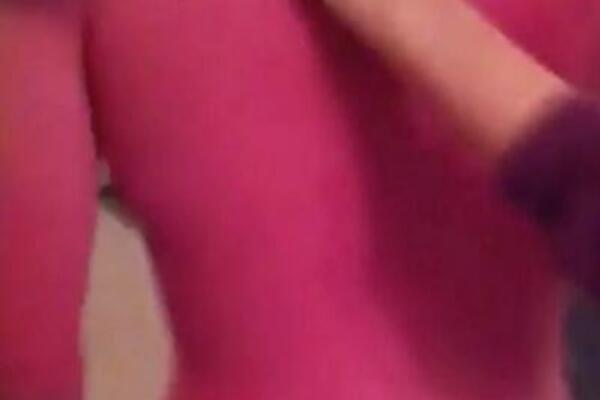 GDE JE KOŽA? Potpuno IZGOREO na suncu: Vrištao od BOLOVA, jeziv PRIZOR! (FOTO)