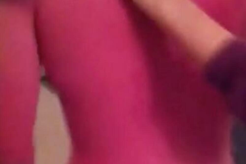 GDE JE KOŽA? Potpuno IZGOREO na suncu: Vrištao od BOLOVA, jeziv PRIZOR! (FOTO)