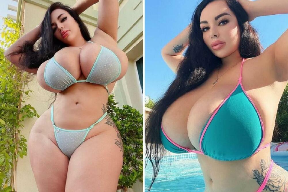 OGROMNE GRUDI SU JOJ UNIŠTILE ŽIVOT: A sada se desio VELIKI PREOKRET (FOTO)