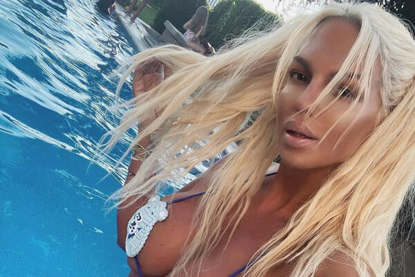 KARLEUŠA KONAČNO PRIZNALA KO JOJ JE HIRURG!