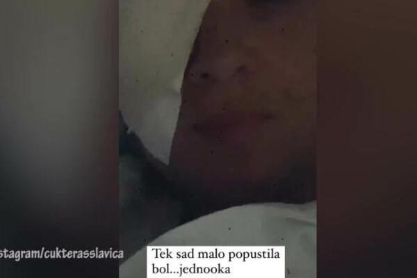 PRVI SNIMCI SLAVICE ĆUKTERAŠ IZ BOLNICE: Sva u zavojima, pola lica joj se ne vidi! (VIDEO)