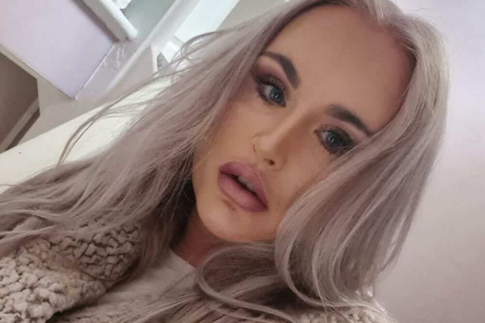 Tarin porođaj je mnoge ZGROZIO zbog jedne stvari: Retko ko bi imao želudac za ovako nešto, ali BEBA je tu