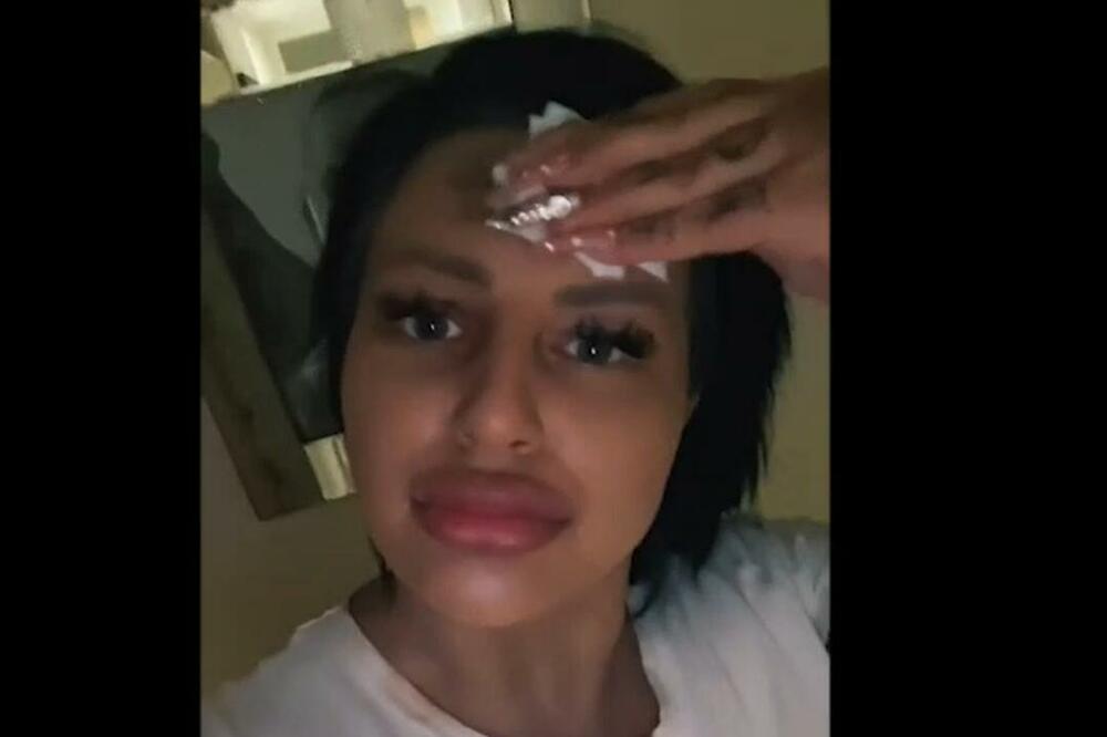 ZAŠTO TO LJUDI RADE NA LICU? Devojka skinula puder, otkrila celom svetu ISTINU, a onda su počeli KOMENTARI!