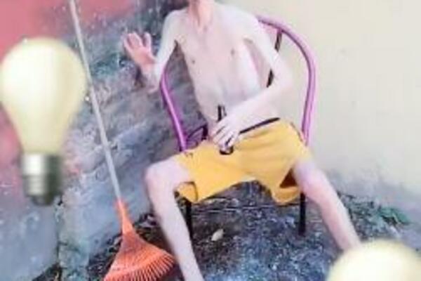 STRAŠNO U KAKVO STANJE SE DOVEO: Hitno mu je potreban pregled lekara! (VIDEO)