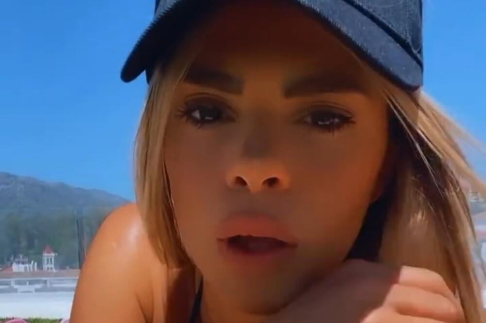 BIVŠA ZADRUGARKA NAPUMPALA USNE! Pogledajte kako sada izgleda! (FOTO)