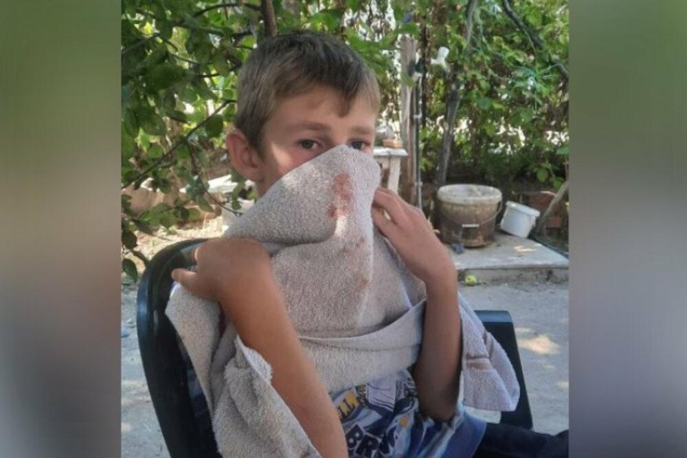 OVO JE MIHAJLO (12) KOG SU ALBANCI NAPALI U CENTRU KOSOVSKE KAMENICE: Udarali ga dok se VRAĆAO IZ PRODAVNICE (FOTO)