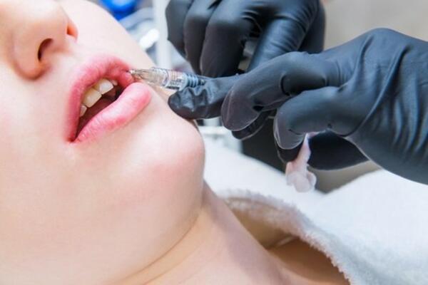 PLASTIČAR JOJ NAPUMPAO USNE, A ONA POBEGLA! Policija traži LEPOTICU SA FILERIMA!