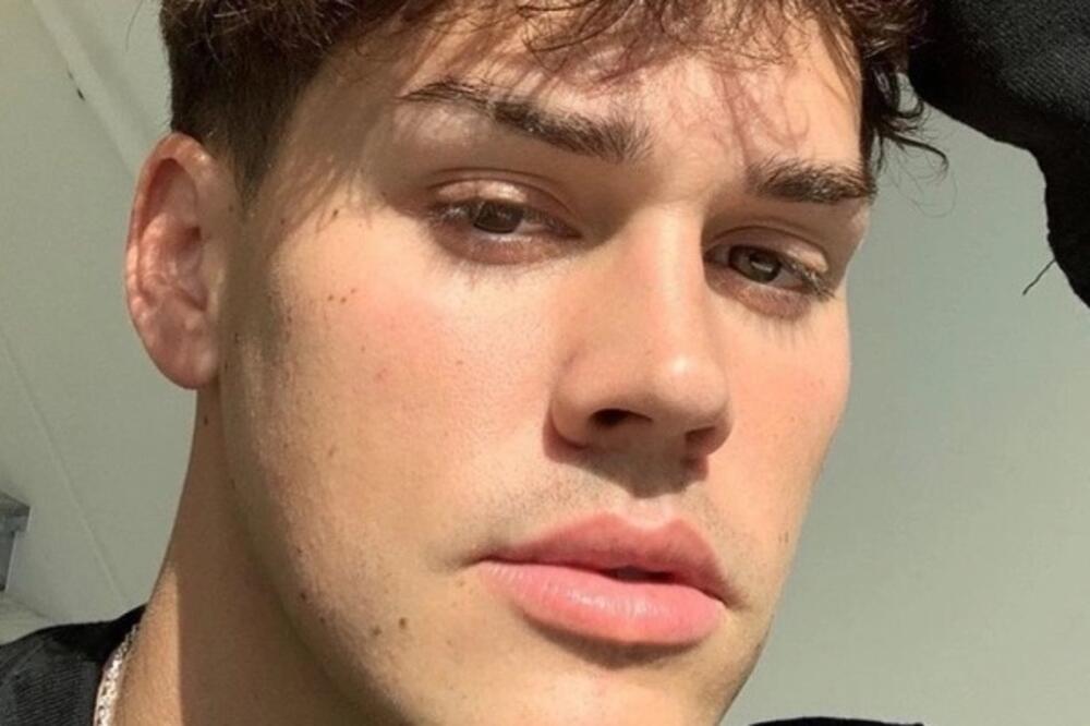 OMILJENI TIKTOKER SE BORI SA MENTALNIM POREMEĆAJEM! Otkriveni problemi sa kojima se suočava, NIJE NAIVNO!