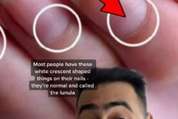 NE ZANEMARUJTE UPOZORENJE: Ova promena na NOKTIMA ukazuje na skrivenu BOLEST!