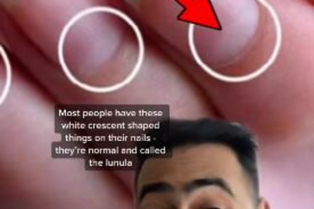 NE ZANEMARUJTE UPOZORENJE: Ova promena na NOKTIMA ukazuje na skrivenu BOLEST!