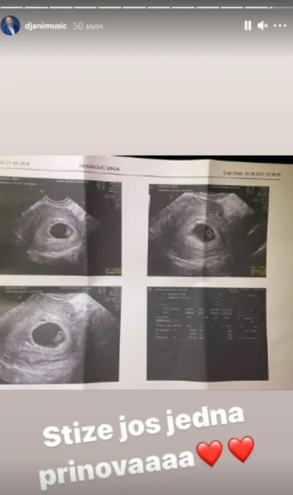 Radiša Trajković Đani