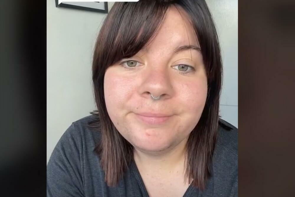 PRIHVATILA JE SEBE SA DLAKAMA NA LICU: Ismejavaju je, a evo sa kojim se problemom ona suočava! (VIDEO)