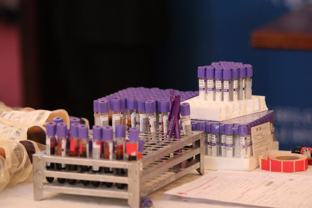 AKO U ANALIZI KRVI VIDITE OVE VREDNOSTI ZNAČI DA VAM CRP NIJE DOBAR: Evo koju granicu ne sme da pređe