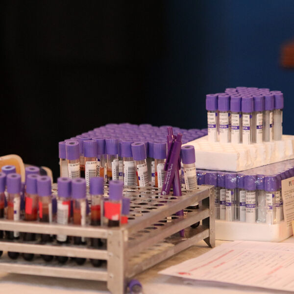 HITAN APEL INSTITUTA ZA TRANSFUZIJU KRVI SRBIJE: Kovid samo otežava situaciju