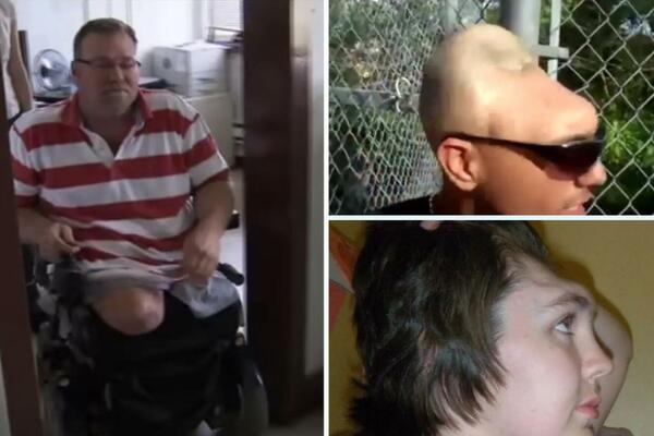 POBEGLI OD SIGURNE SMRTI: Bizarne nesreće koje će vas ZAPREPASTITI i inspirisati! (FOTO/VIDEO)