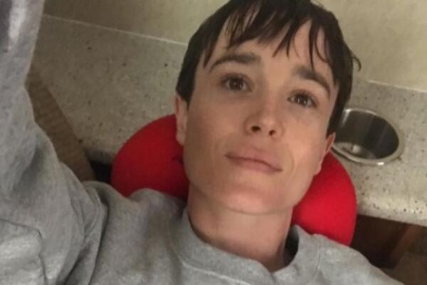 NEKADA SLATKA DEVOJKA, A DANAS MAČO MUŠKARAC: Evo kako izgledaju GRUDI nakon što ih OPERIŠU TRANSRODNI LJUDI, ŠOK