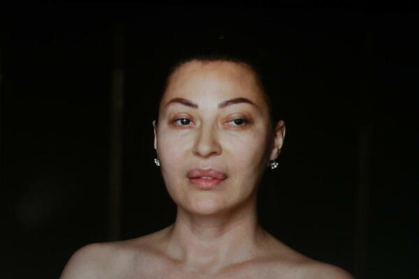 NI CECA, JECA, NI PRIJA NISU BILE SAVRŠENE PRE OPERACIJA! Krenuće vam suze kada vidite REALNE SLIKE: Brdo operacija