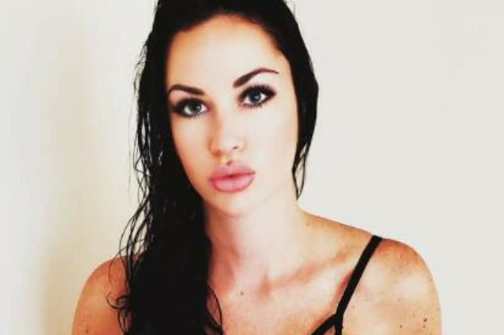 "NEKONTROLISANO SE ZNOJIO, A KADA JE USTAO VIDELA SAM DA JE NAPALJEN": Zgodna Amy zajaukala NA SAV GLAS zbog 1 FOTO