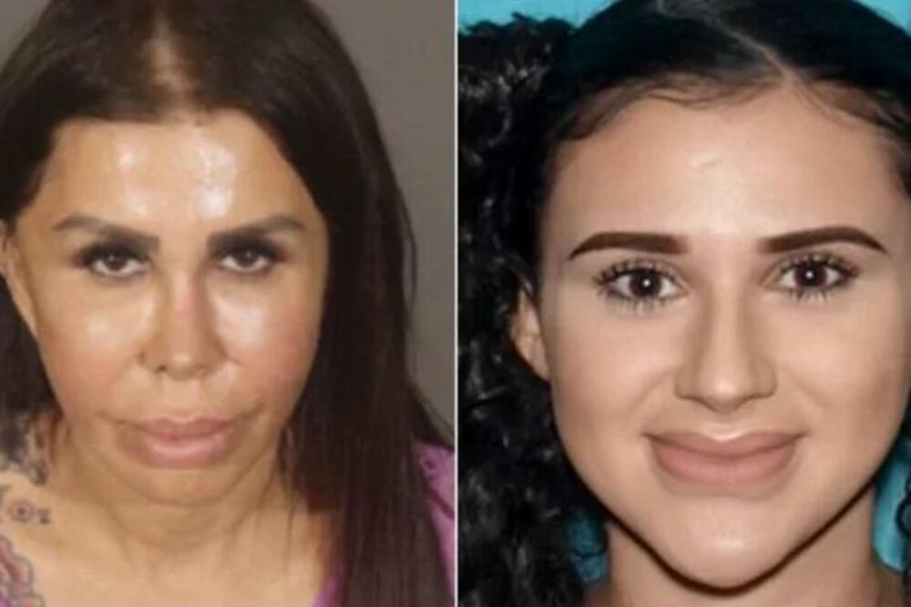 MAJKA I ĆERKA IZ PAKLA UBILE PACIJENTKINJU kojoj su obećale SAVRŠENU ZADNJICU! Lažne plastične hirurškinje (FOTO)