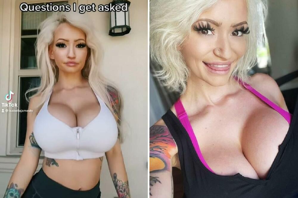 PROŽIVLJAVALA JE PAKAO JE ZBOG OGROMNIH GRUDI: Sada su JOŠ VEĆE, ima više PLASTIKE U NJOJ NEGO U OKEANU! Sama KAŽE!