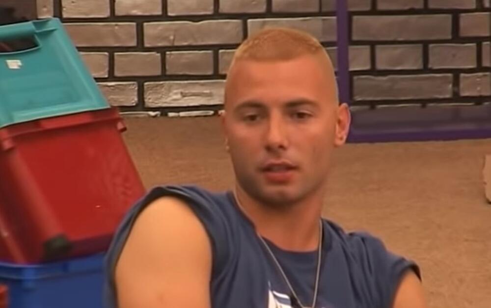 Pre estetskih korekcija