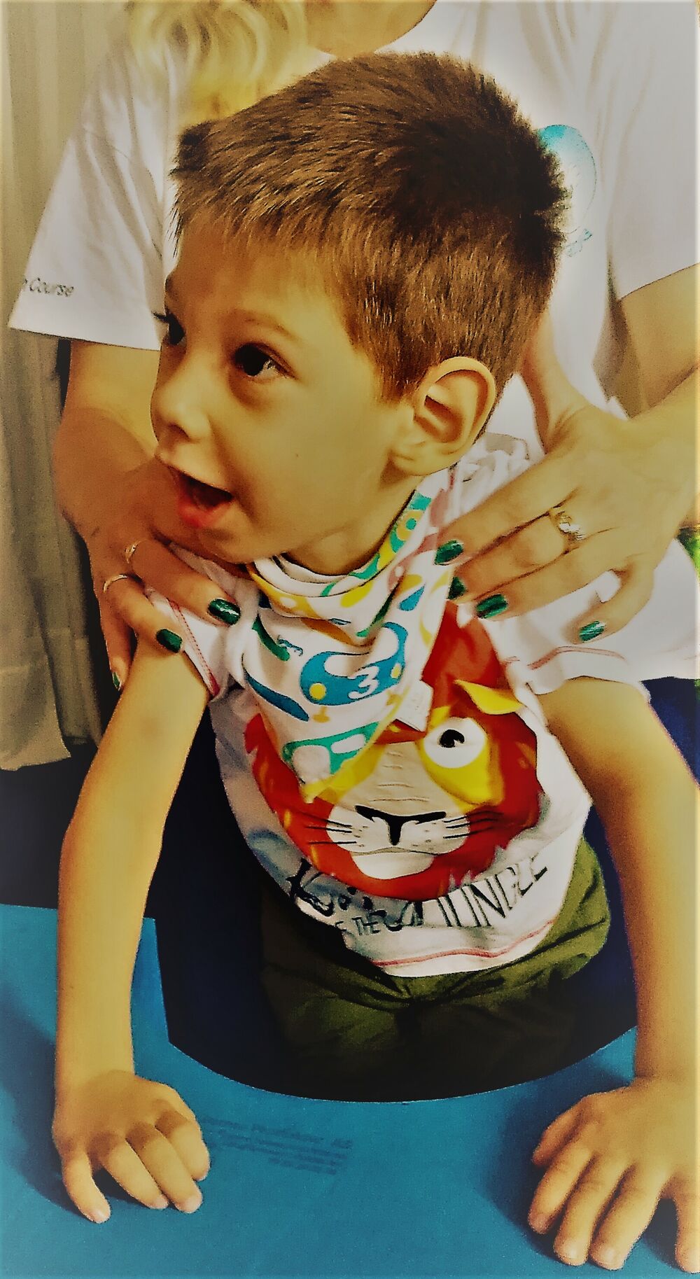 Filip Radojičić, Cerebralna paraliza