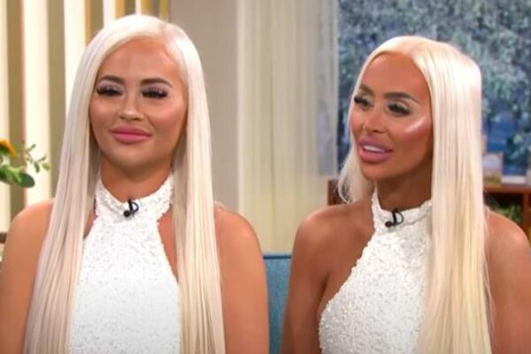 BLIZNAKINJE DALE ENORMNU KOLIČINU NOVCA DA BI IZGLEDALE APSOLUTNO ISTO: "Želimo da budemo iste i DOLE" (FOTO/VIDEO)