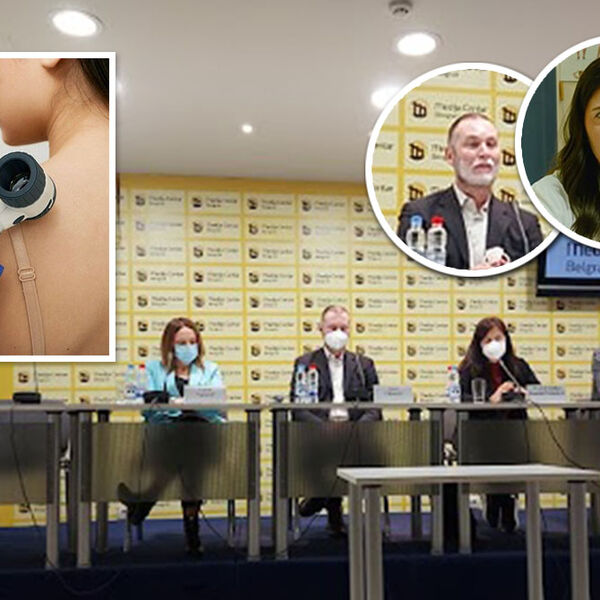 MELANOMI NISU NEIZLEČIVO OBOLJENJE! Lekari su nam otkrili kako da ga PREPOZNAMO i šta je najčešća ZAMKA (FOTO)