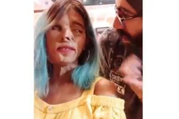 OTAC JE ŽENU I DETE POLIO KISELINOM ZBOG 1 JEZIVE STVARI: Devojčica je PREŽIVELA, ali ostala IZDEFORMISANA! (FOTO)