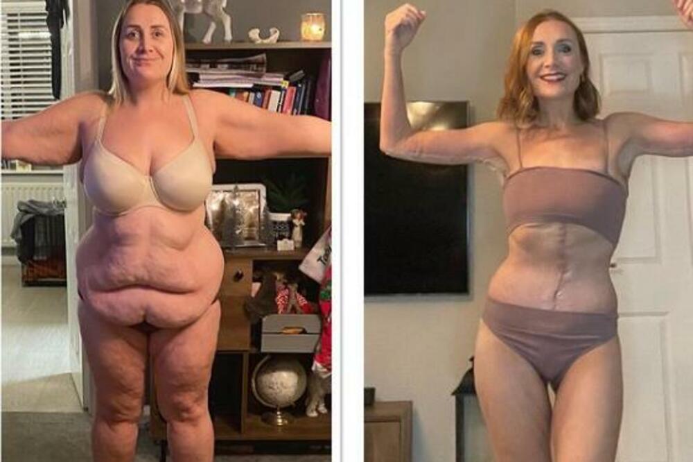 ČUDESNA TRANSFORMACIJA: Mama troje dece spucala PRAVO BOGATSTVO na izgled, pogledajte KAKO SAD IZGLEDA!