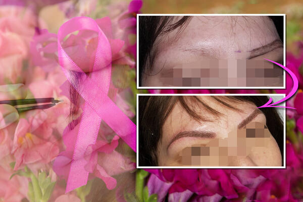 SUZANA ULEPŠAVA ŽENE KOJE SU PROŠLE HEMOTERAPIJU! Njena usluga je BESPLATNA, a rezultat će vas ostaviti BEZ TEKSTA