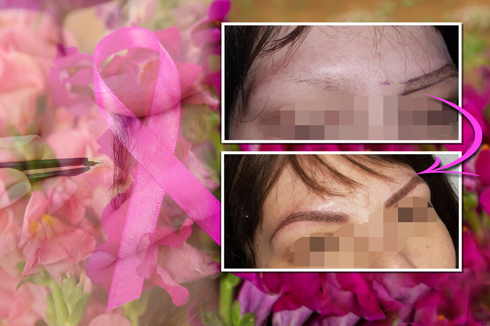 SUZANA ULEPŠAVA ŽENE KOJE SU PROŠLE HEMOTERAPIJU! Njena usluga je BESPLATNA, a rezultat će vas ostaviti BEZ TEKSTA