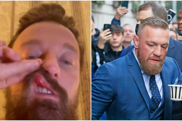 KONOR MEKGREGOR PRETUKAO ITALIJANSKOG MUZIČARA: "Napao me iz čista mira, razbio mi usta i SLOMIO NOS!" (VIDEO)