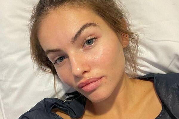 NEKAD NAJLEPŠA DEVOJČICA NA SVETU HITNO OPERISANA: Svi su mi govorili da ne brinem, ali je cista bila OGROMNA!