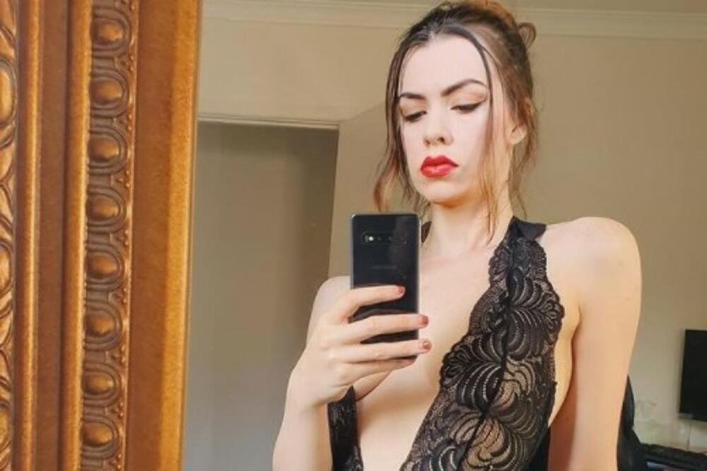 ONA JE MODEL BEZ NOGE I NAŠLA SE NA ŽESTOKOM UDARU: Optužuju je za GNUSNU STVAR (FOTO)