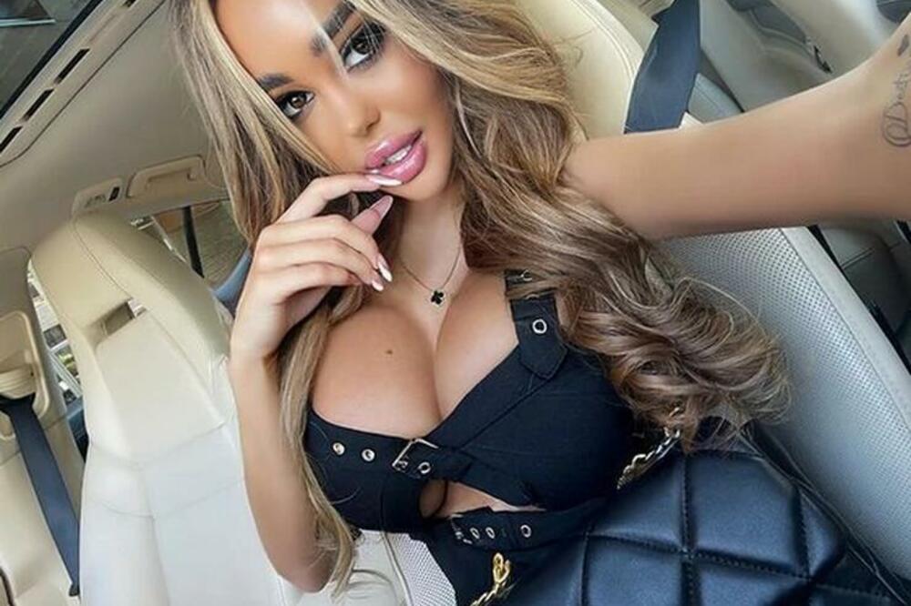 OVAKO JE ANA KORAĆ IZGLEDALA PRE PLASTIČNIH OPERACIJA!