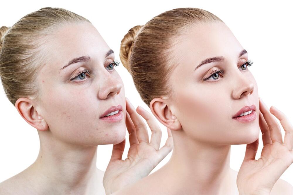 ŠTA VAŠ OBLIK LICA GOVORI O VAMA? Stručnjaci su pojasnili, IMA SMISLA!